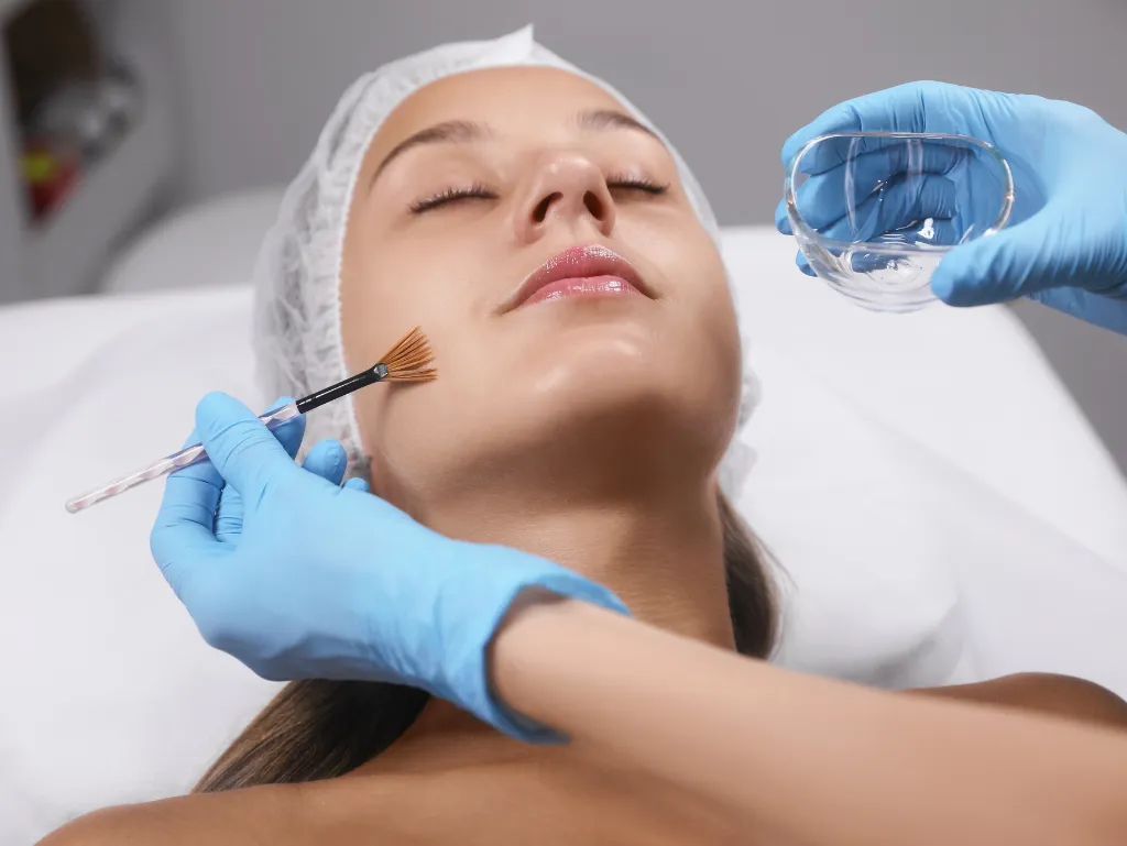 VI Peel Treatment Sandpoint ID 11zon